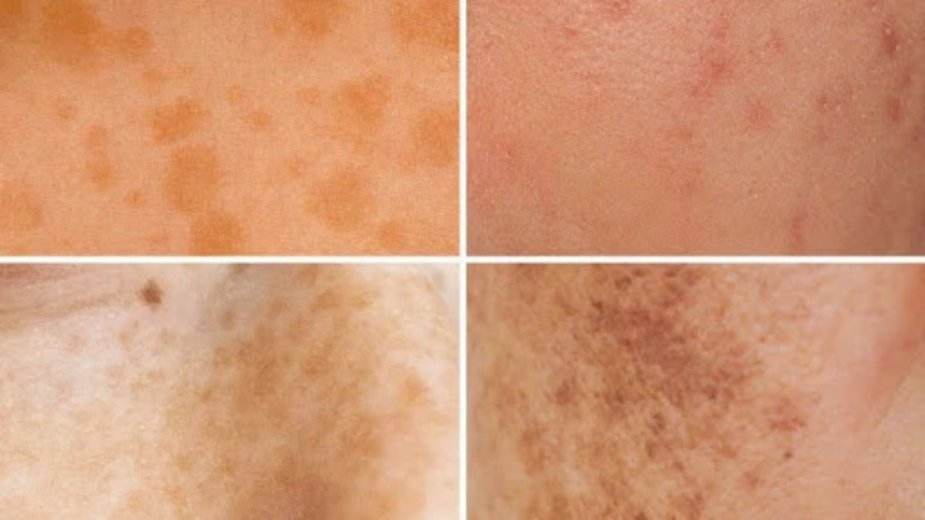Blog banner for how to fade dark spots