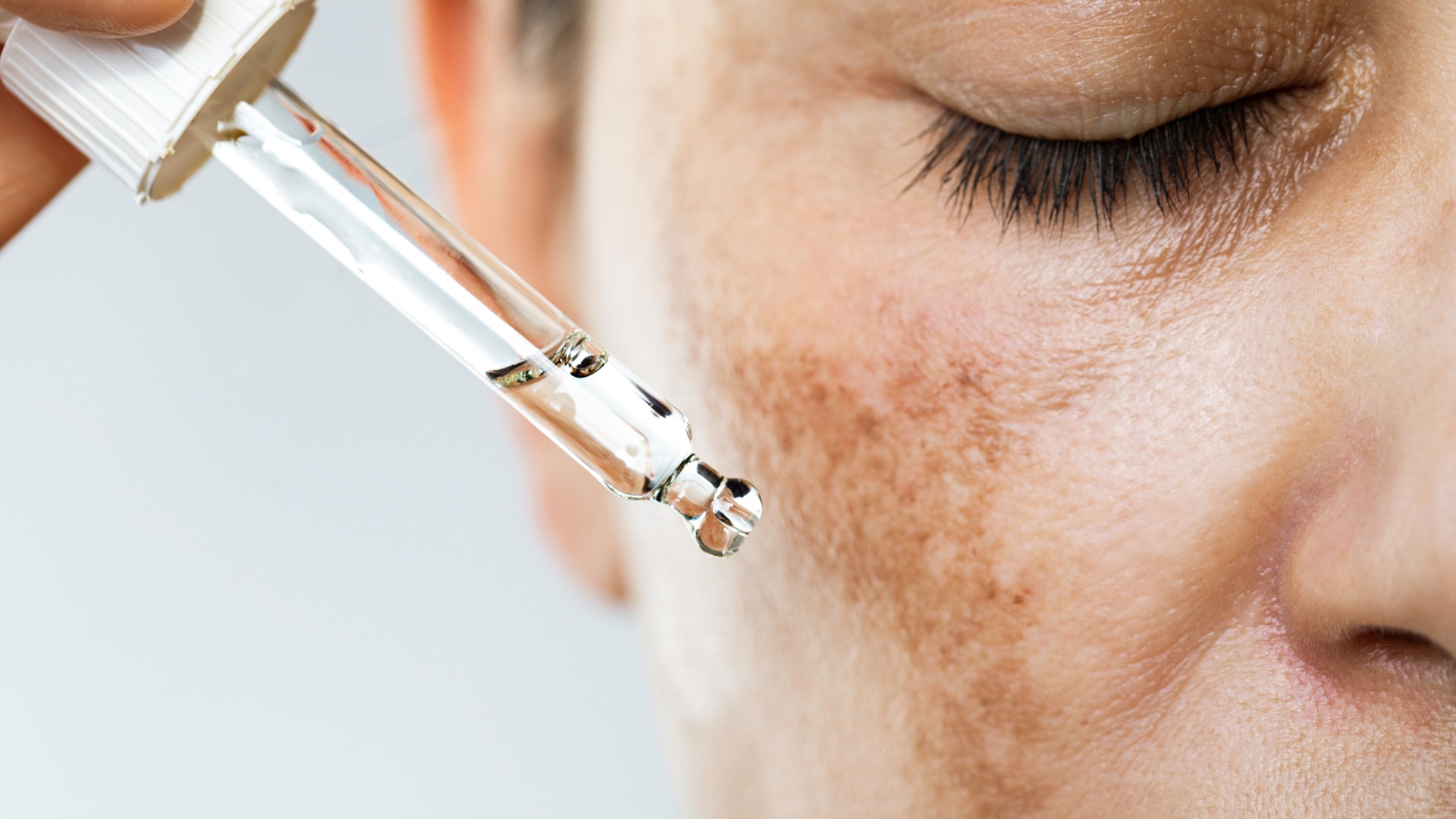 Serum treatment